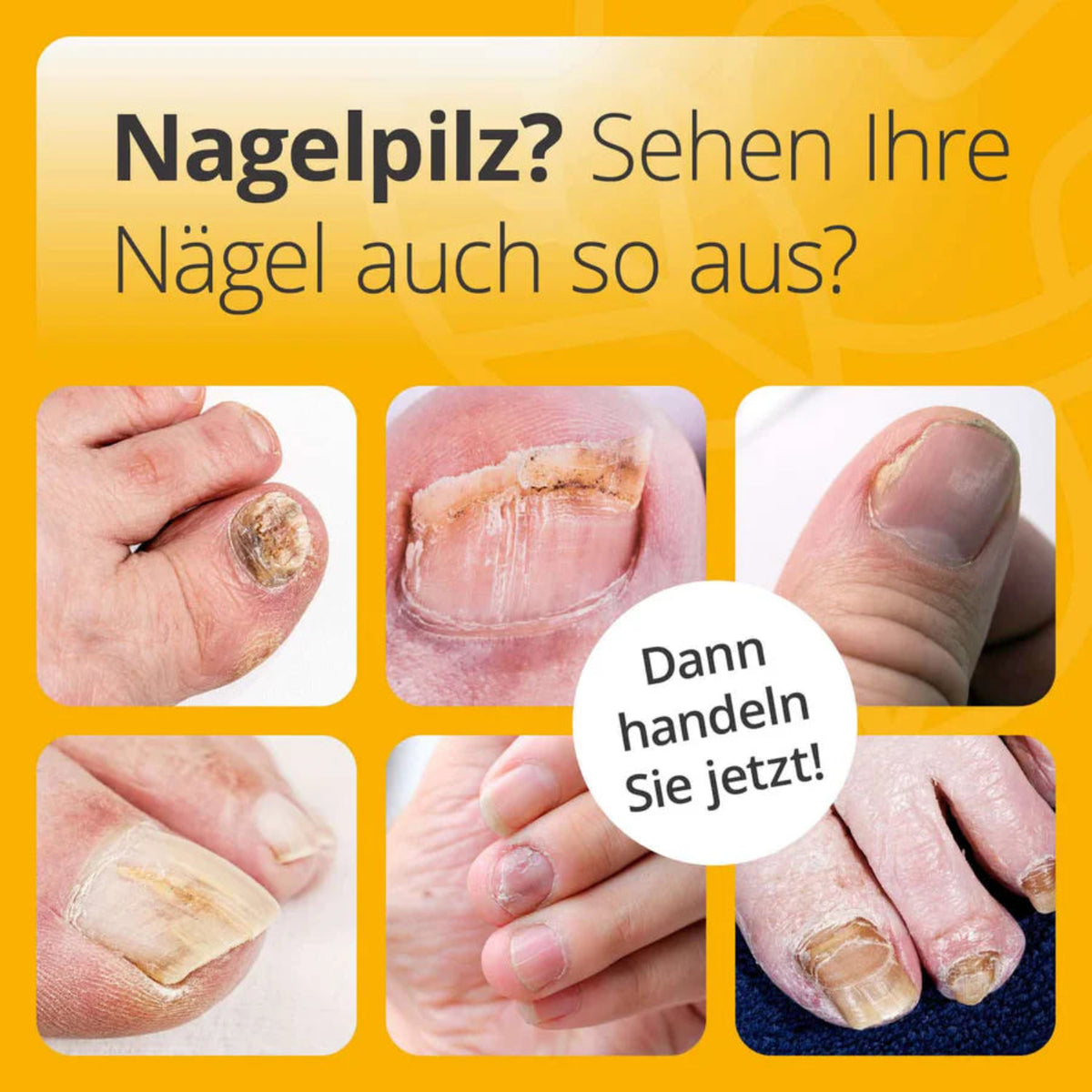 Repair & Protect Fußpflege-Komplettset Nagelpilz