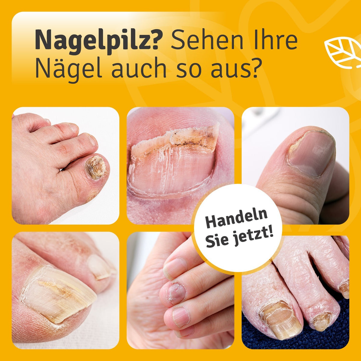 Nagelöl Repair & Protect Nagelpilz Diagnose