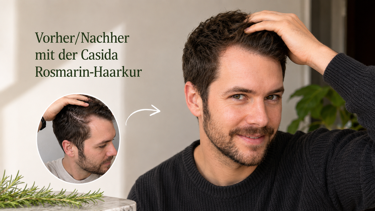 Vorher-Nachher-Werbegrafik zur Casida Rosmarin-Haarkur mit Mann und Haaransatz-Aufnahme.