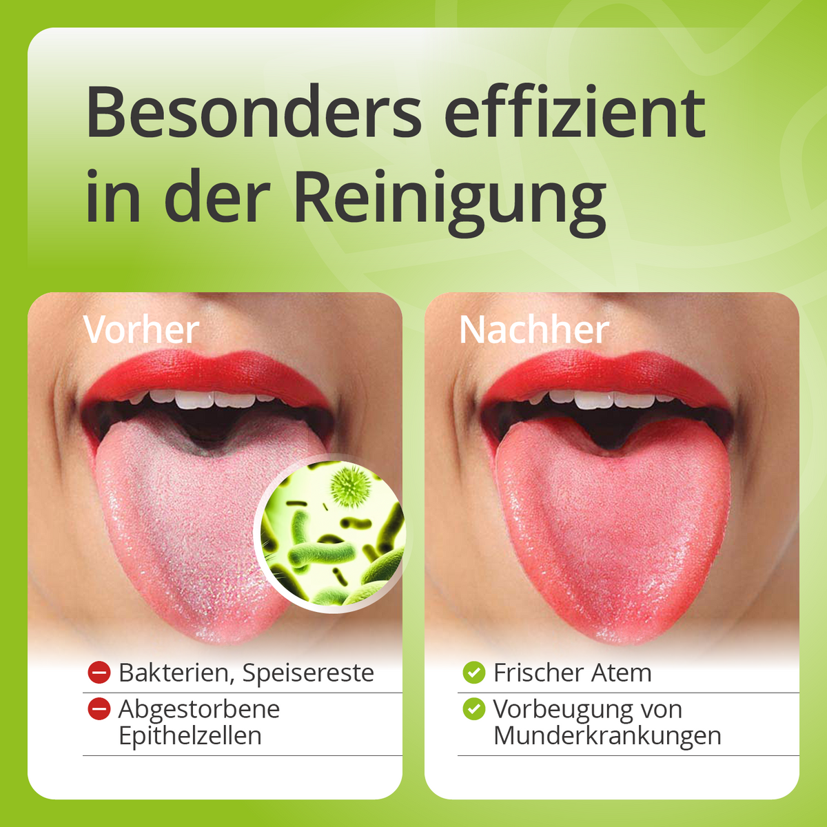 Mundgesundheit Set Zungenreiniger Anwendung Vergleich